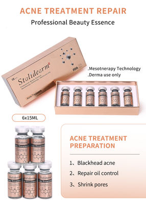Melhor produto de tratamento da acne facial Remover acne Pele lisa e encolher poros soro clareador Esença de clareamento