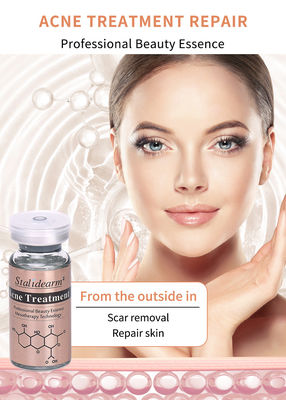 Melhor produto de tratamento da acne facial Remover acne Pele lisa e encolher poros soro clareador Esença de clareamento