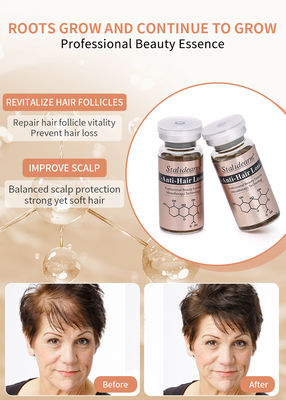 Melhor Qualidade Tratamento Anti-Perda de Cabelo Cuidados Capilar Prevenção de Perda de Cabelo Sérum de Crescimento de Cabelo
