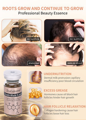 Melhor Qualidade Tratamento Anti-Perda de Cabelo Cuidados Capilar Prevenção de Perda de Cabelo Sérum de Crescimento de Cabelo