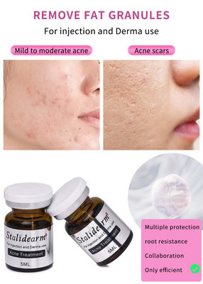 Remover cicatrizes Rejuvenescimento da pele Tratamento facial Sero Ance Tratamento Preenchimentos Injecção