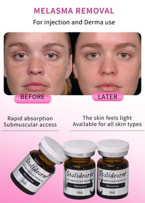 Conjunto de Injecção de Fluido de Soro Anti-Melasma de 5 ml com personalização OEM