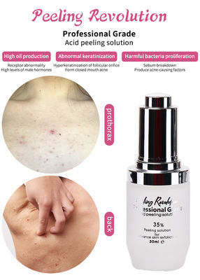 Serum de Esfoliação da Pele de Grau Profissional Produtos de Cuidados da Pele Limpeza Reparação da Pele Revitalize Solução Esfoliação