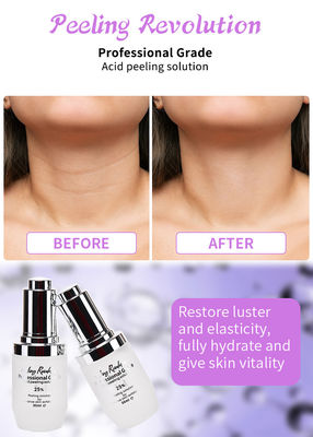 Sero de Esfoliação Facial de Grau Profissional para Solução de Peeling de Pele