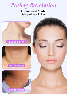 Sero de Esfoliação Facial de Grau Profissional para Solução de Peeling de Pele