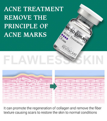 Soro claro da espinha pura da planta que clarea o tratamento Mesotherapy para cicatrizes da acne