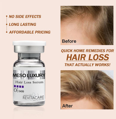 Marca própria feita sob encomenda natural erval do tratamento 10ml do soro da rebrota do cabelo