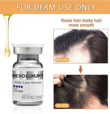 Marca própria feita sob encomenda natural erval do tratamento 10ml do soro da rebrota do cabelo