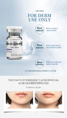 Essência facial OLEOSA do tratamento de Microneedling do soro meso da pele do OEM