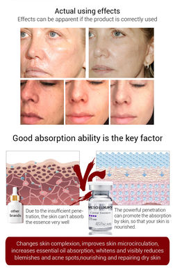 Mitigação firmando o soro meso da essência do caviar de Microneedling Mesotheraphy do soro