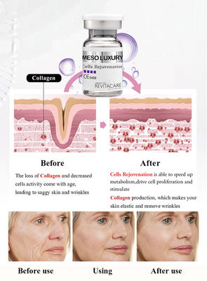 Pilha meso que rejuvenesce o soro Microneedling antienvelhecimento do poder para o alvejante da pele