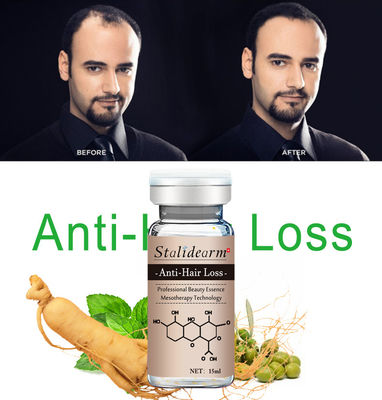 soro natural Microneedling do crescimento do cabelo do anti ingrediente da planta do soro da queda de cabelo 10ml