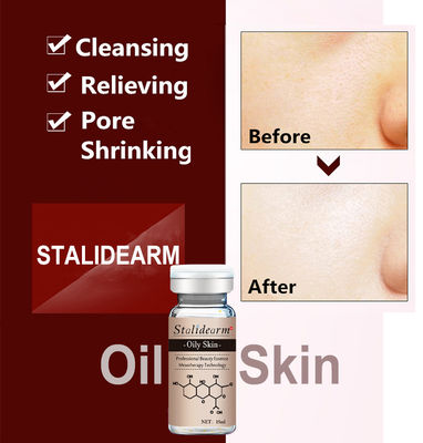 Sérum de Microneedling para Tratamento de Acne Mesoterapia Anti Acne Rótulo Personalizado Caneta Dermal Essência Facial para Pele Oleosa