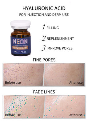 Clareando a pele meso do soro da terapia que ilumina as injeções 5ml ácidas hialurónicas antienvelhecimento