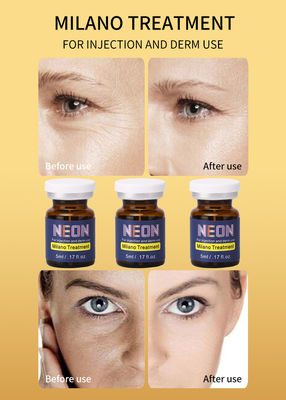 Do soro meso da terapia de Milão o preto de néon da sarda mancha o soro do tratamento de Melasma