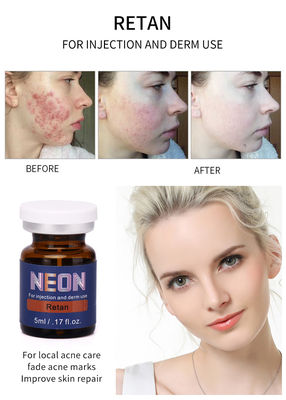 Essência pura do soro meso de néon do tratamento da acne da injeção 5ml do soro da terapia