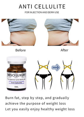 Soro de queimadura gordo da anti barriga perdedora meso do peso do emagrecimento do soro das celulites