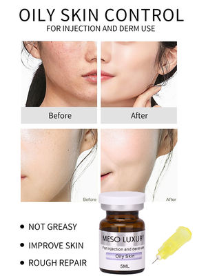 Tratamento com Exossomos Skin Booster MESO Serum Solução de Mesoterapia para Pele Oleosa