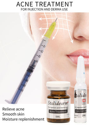 Soro Mesotherapy da injeção do tratamento da acne de Stalidearm que não nutre nenhum efeito secundário