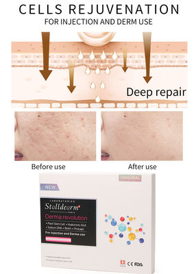 Injeção dos cuidados com a pele de Stalidearm 5ml da injeção do soro da juventude do rejuvenescimento das pilhas