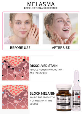Cofre forte do soro do uso da injeção de Melasma e bom grupo do soro de Mesotherapy 5ml/bottle do efeito