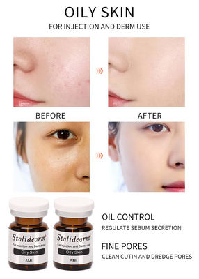 O soro da injeção para essência segura oleosa do efeito da pele 5ml/Bottle a boa ajustou o tipo original de Stalidearm