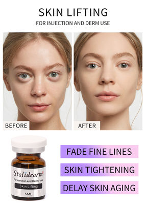 Exossomas Skin Booster Stalideram Anti- envelhecimento Skin Lifting Solução mesoterápico injectável